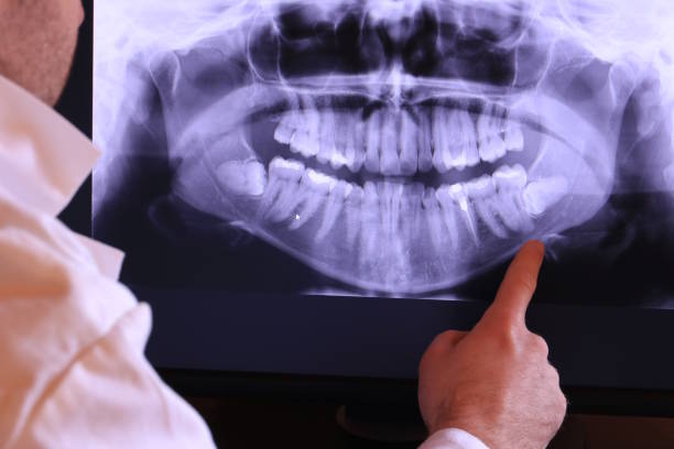 Best Emergency Dental Care for Sports Injuries in Chapman, KS