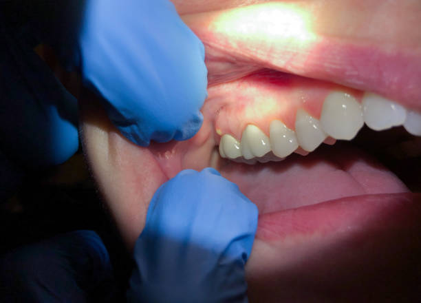 Professional Emergency Dental Service in KS