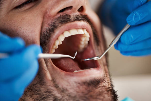 Best Emergency Pediatric Dental Care in Chapman, KS